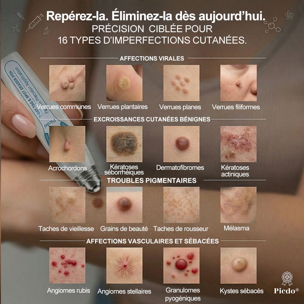Roller Picdo® - 7 Jours pour une peau plus nette • Efface taches & excroissances sans cicatrice