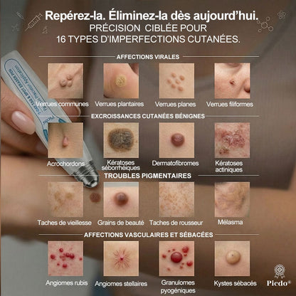 Roller Picdo® - 7 Jours pour une peau plus nette • Efface taches & excroissances sans cicatrice
