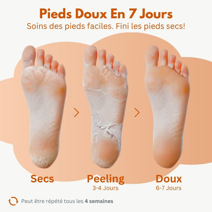 Le masque exfoliant pieds efficace – Des résultats visibles dès 3 jours
