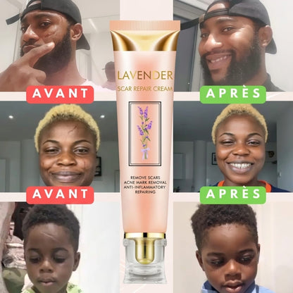 Crème Réparatrice à la Lavande – Réduisez visiblement vos cicatrices en 2 à 4 semaines