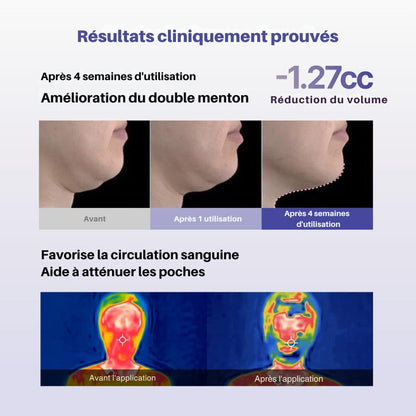 MEDITHERAPY™ – Le secret naturel pour un visage lifté et redessiné en 30 minutes.