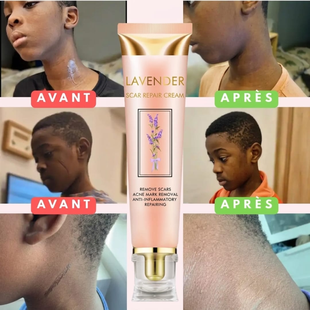 Crème Réparatrice à la Lavande – Réduisez visiblement vos cicatrices en 2 à 4 semaines