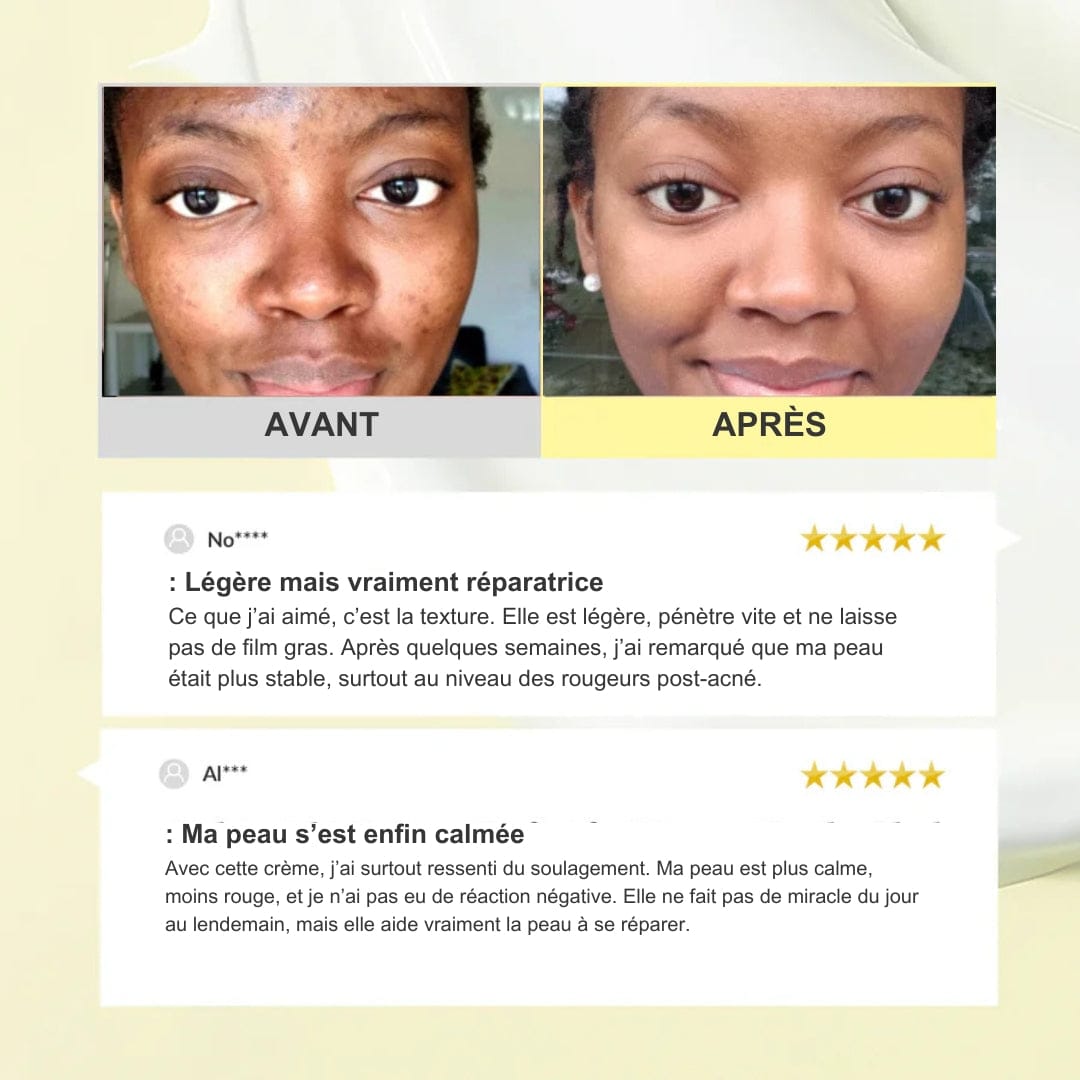 345 Crème Antioxydante – Répare et apaise la peau fragilisée en quelques semaines