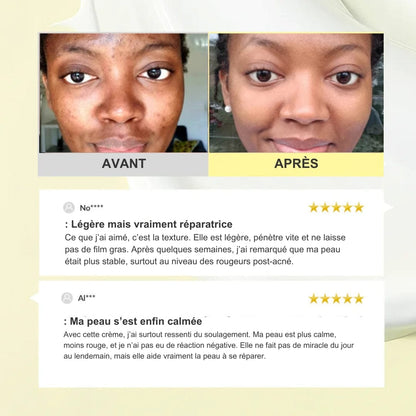 345 Crème Antioxydante – Répare et apaise la peau fragilisée en quelques semaines