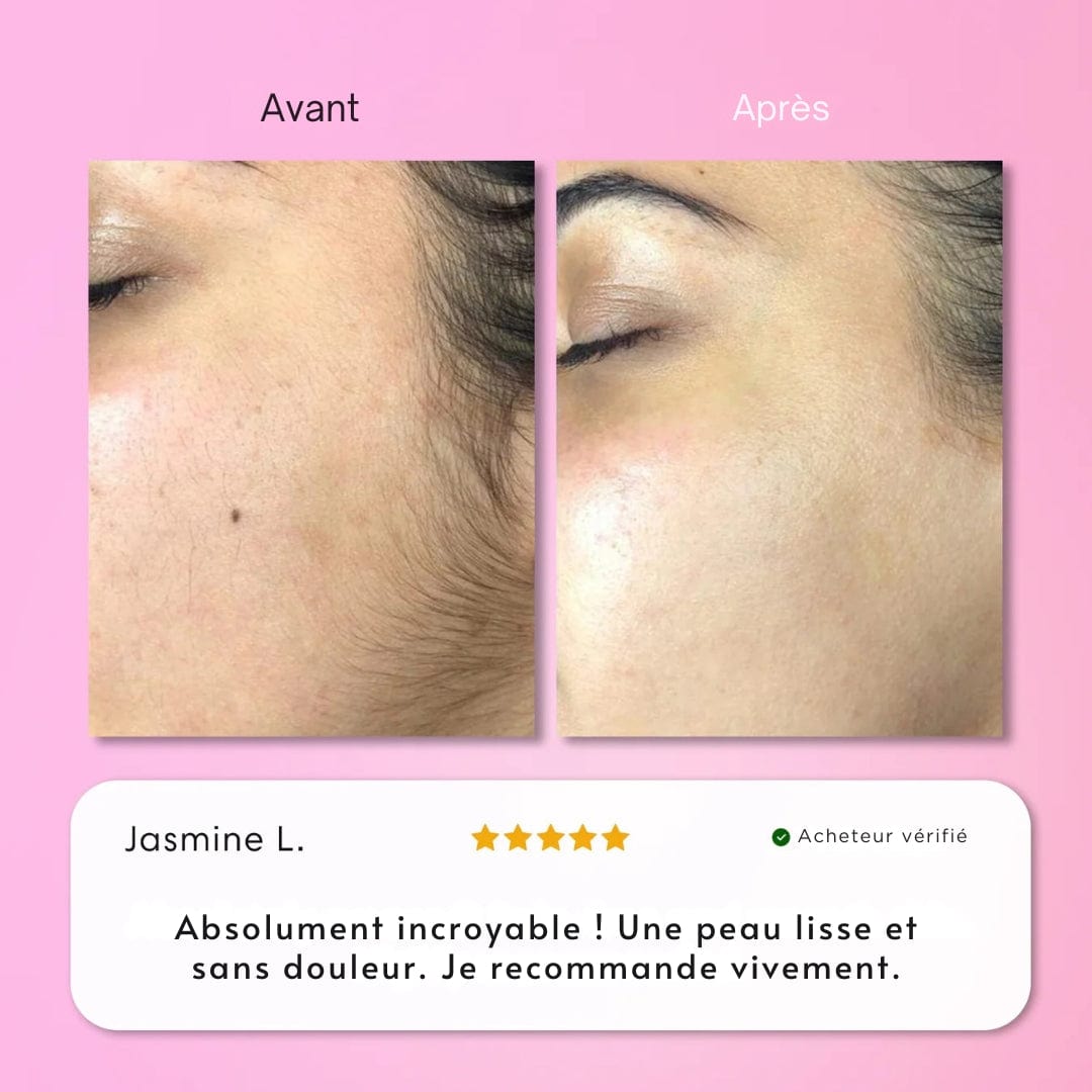 Nicor – Peau douce et nette en 5 min, sans rasoir ni douleur